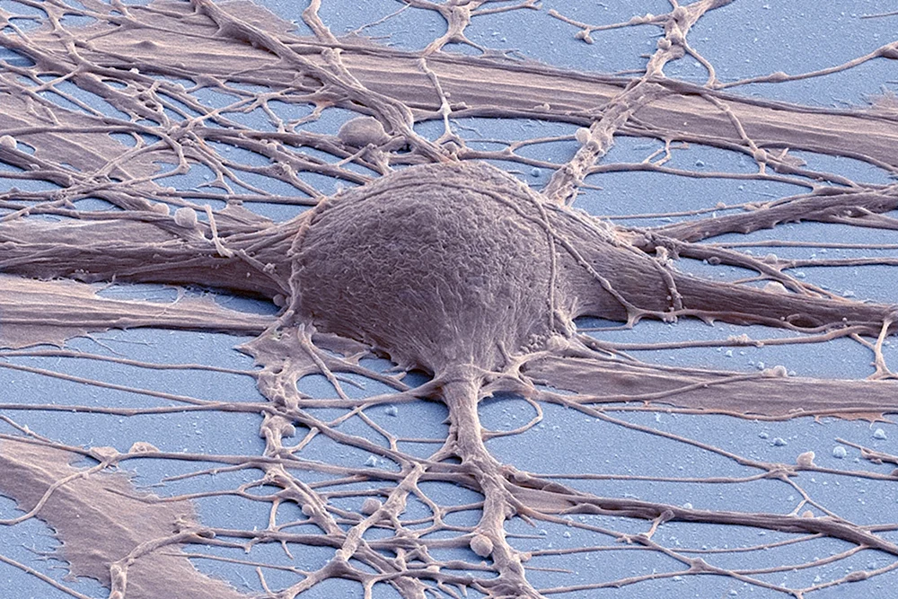 Нейрон клетка мозга человека под микроскопом