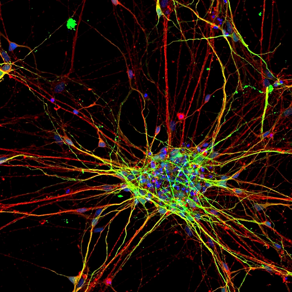 Нейрональная стволовая клетка