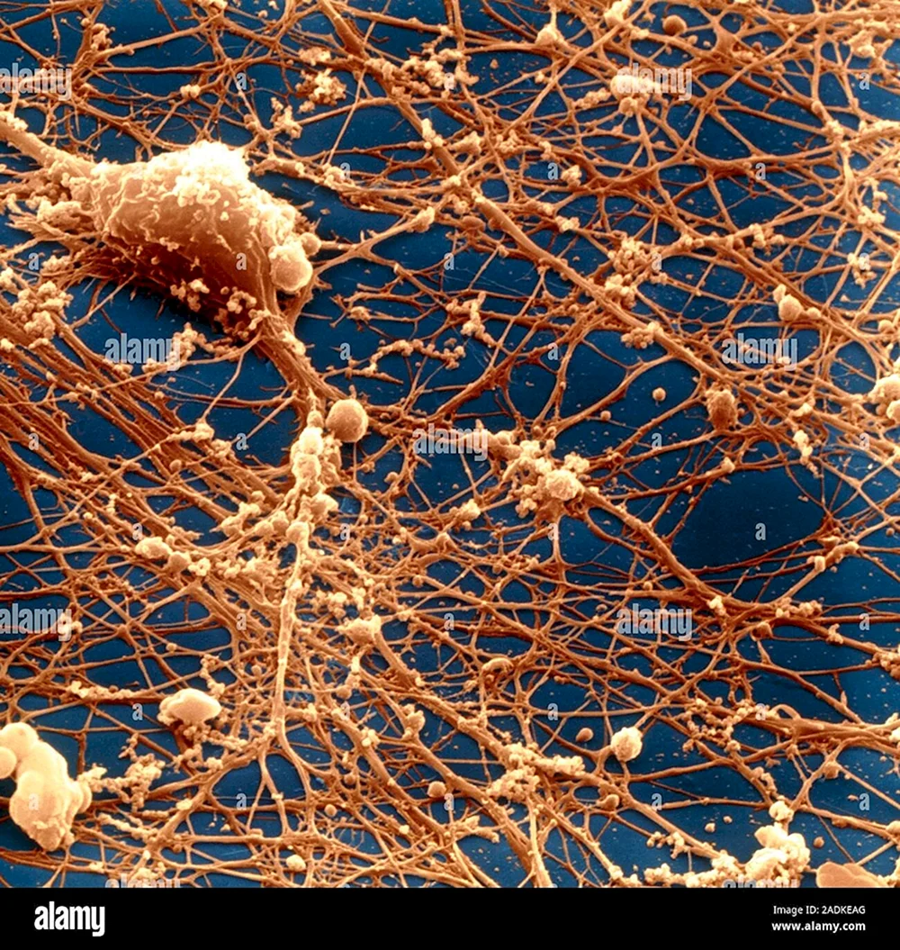 Нейроны мозга под микроскопом